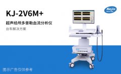 經(jīng)顱多普勒血流標準值范圍 血流速度影響大嗎?