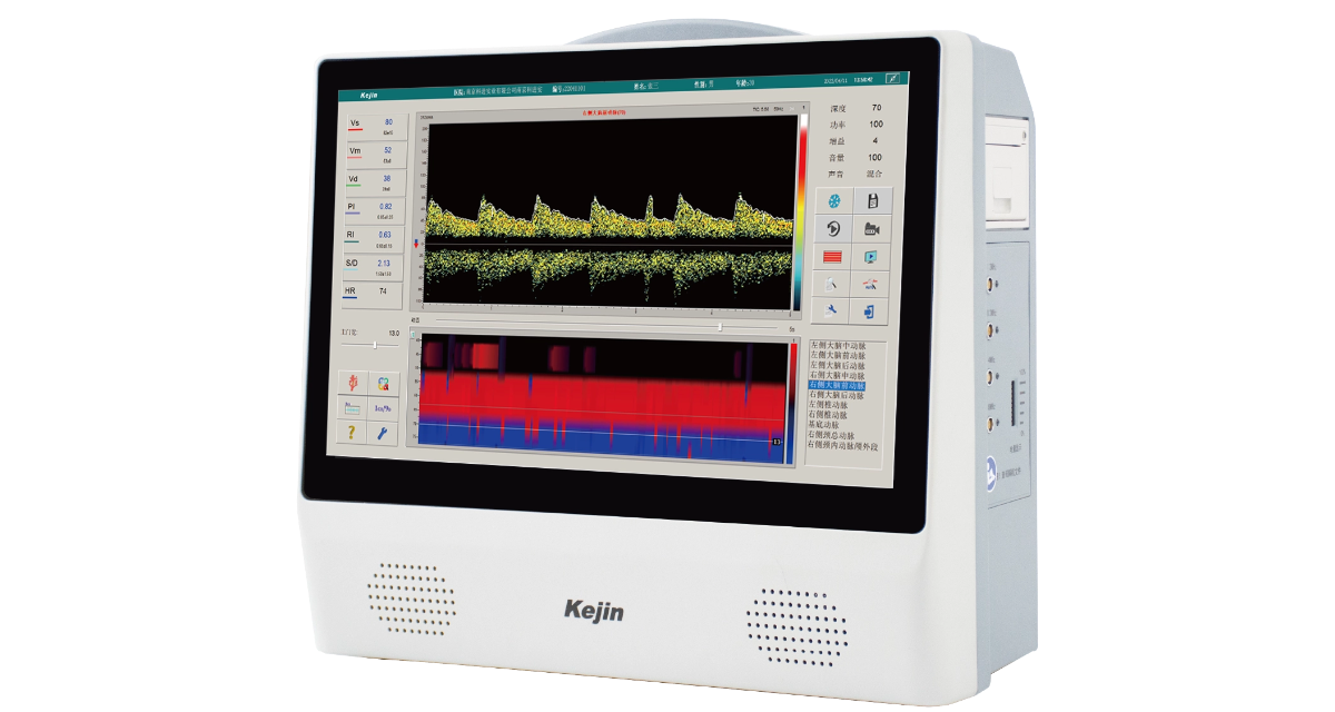超聲經顱多普勒血流分析儀應用示意圖